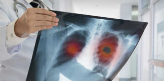 lungs