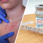 Measles Outbreak Takes Deadly Turn as Pennsylvania Reports First U.S. Deaths