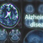 Brain MRI scans with highlighted section and text overlay