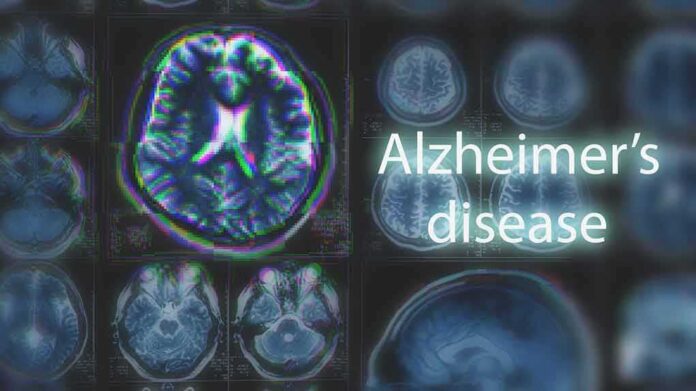 shutterstock_1054068035 Brain MRI scans with highlighted section and text overlay