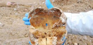 Human skull fragment with teeth held by gloved hands